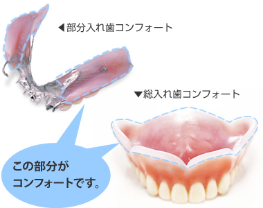コンフォート義歯1