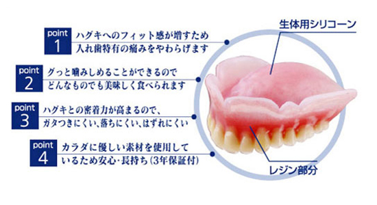 コンフォート義歯2
