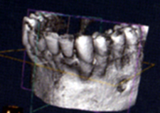 3次元歯科用CTの特徴2