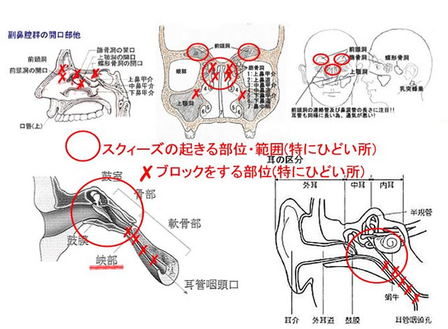 副鼻腔リバースブロック