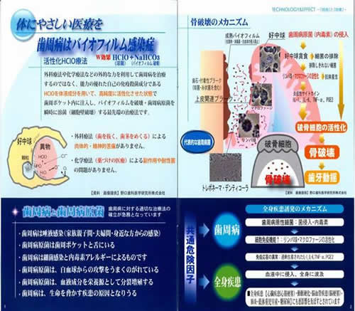 歯周病と歯周病原菌
