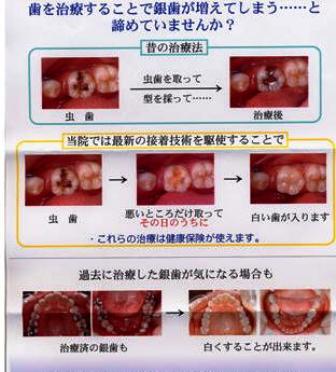 tsume2.jpg